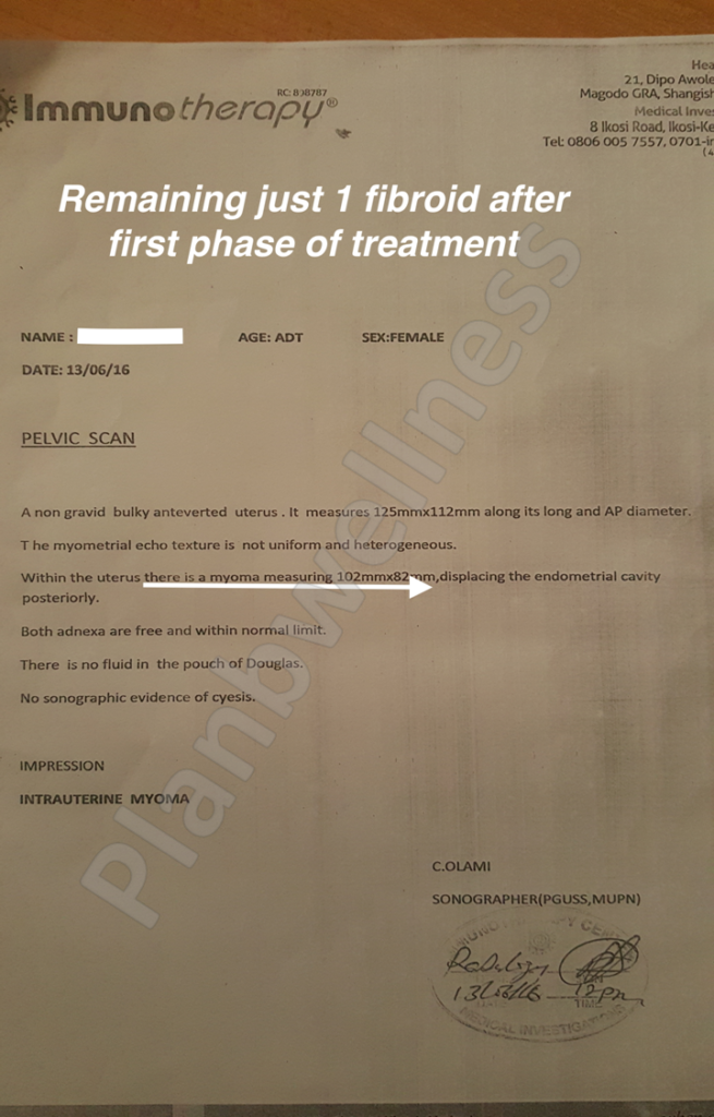 Remaining just 1 fibroid after the first phase of the treatment with Plan B Wellness remedy